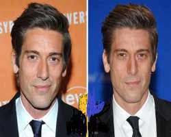 David Muir before surgery